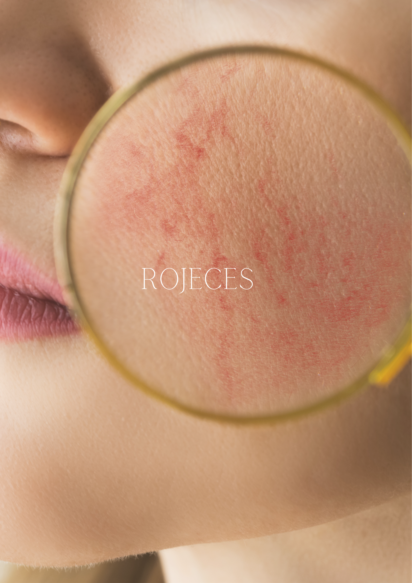 ROJECES