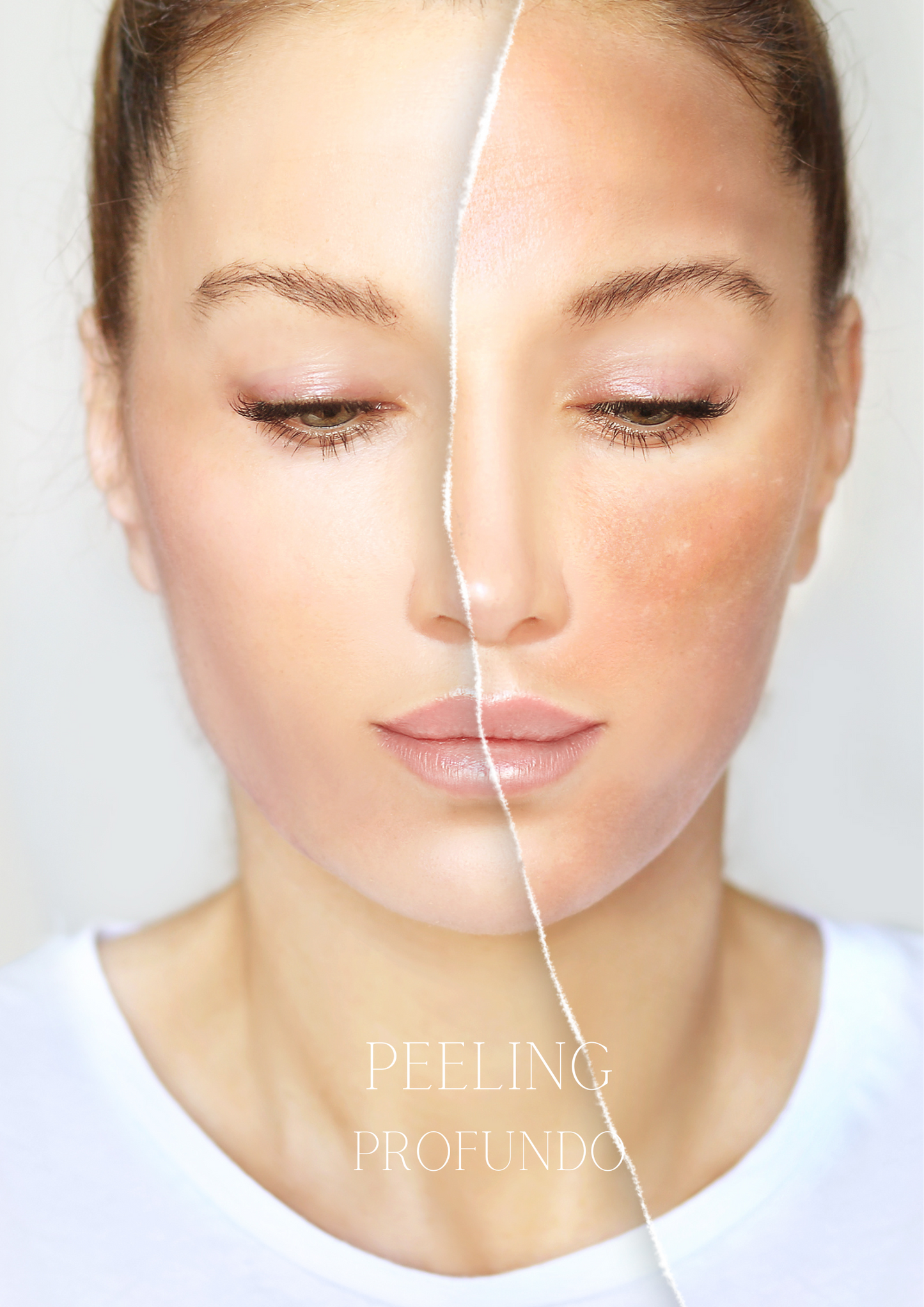 PEELING PROFUNDO