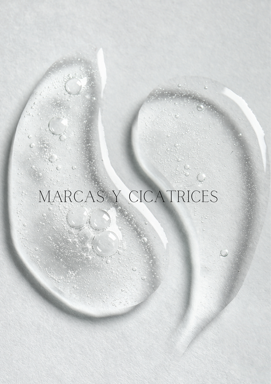 Marcas y Cicatrices ( acné )