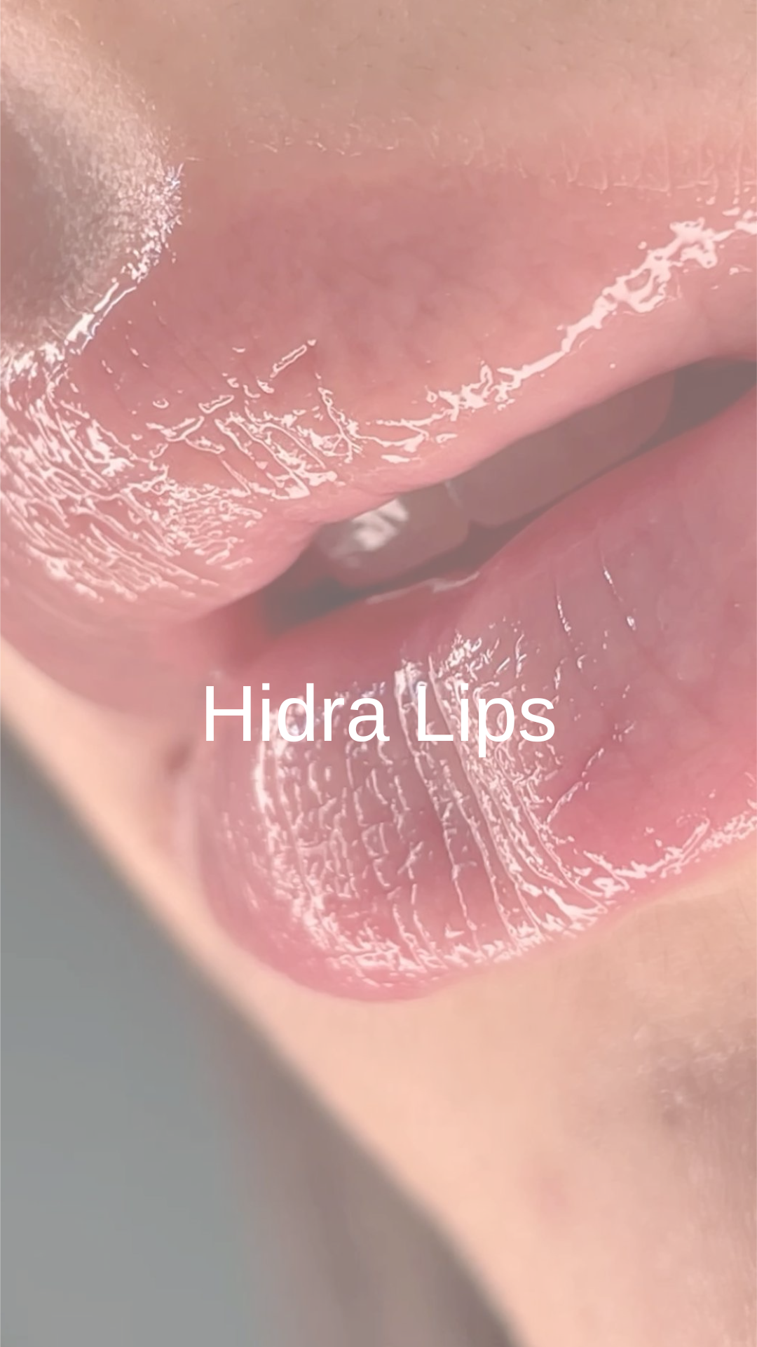 Hidratación y Volumen de Labios