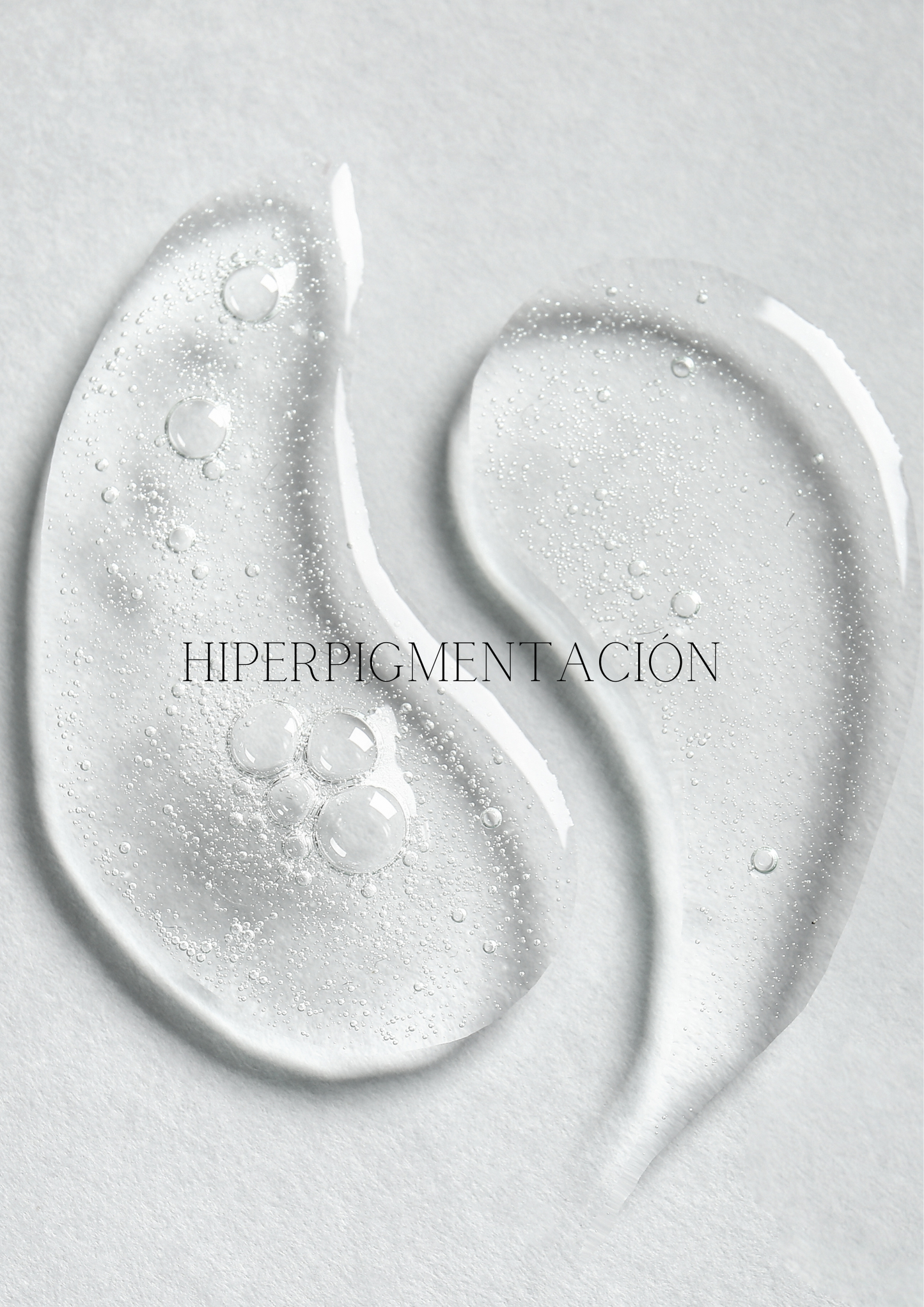 Hiperpigmentación